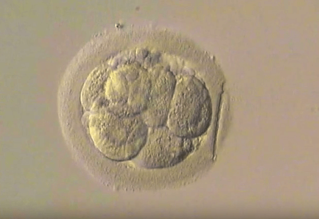 Laser assisted hatching: cosa è lo “sgusciamento assistito” dell’embrione