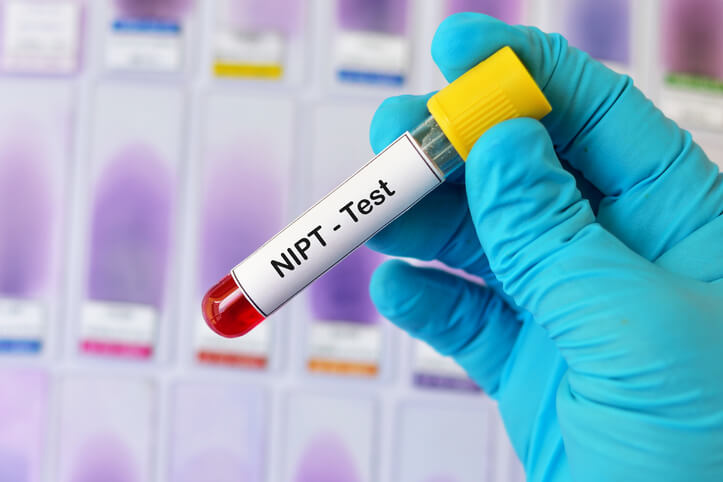 Test prenatale non invasivo: quando e come fare il NIPT