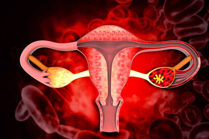 Utero piccolo: problemi di infertilità e rischi per la gravidanza